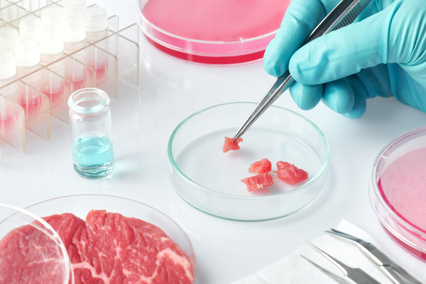 В образцах пищевой продукции выявлены опасные для здоровья бактерии