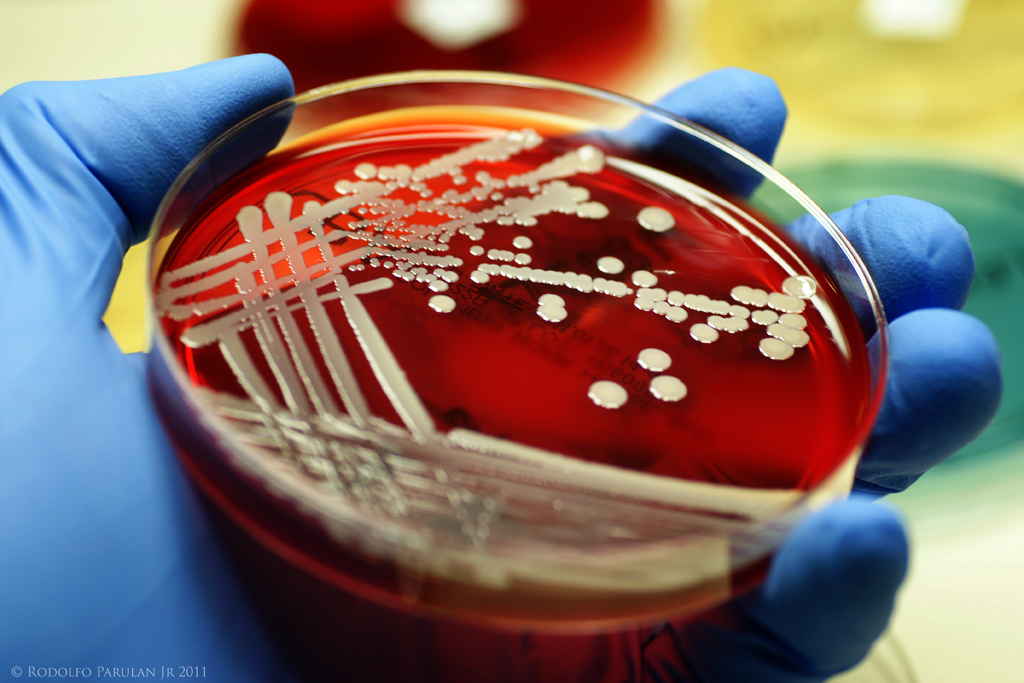 В пробе сыра рассольного обнаружены бактерии S. aureus